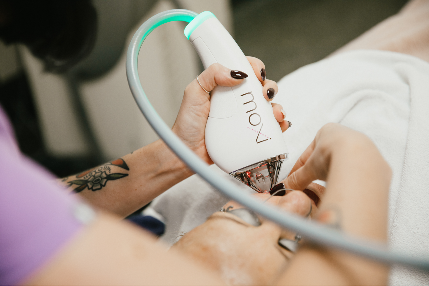 Melasma, Motherhood, and the Moxi Laser: Your Postpartum Pigmentation Plan